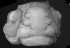 The Glabella